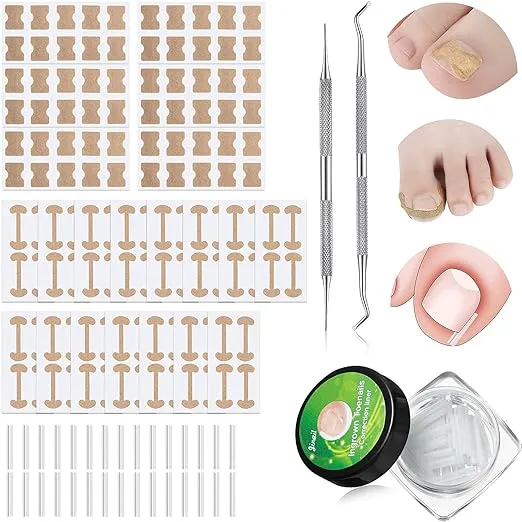 152 Pieces Ingrown Toenail Corrector Treatment Tool Sets, Include Curved Toenail Brace Nail Toenail Corrector Sticker, Ingrown Toenail Corrector Strips, Toenail File and Lifter