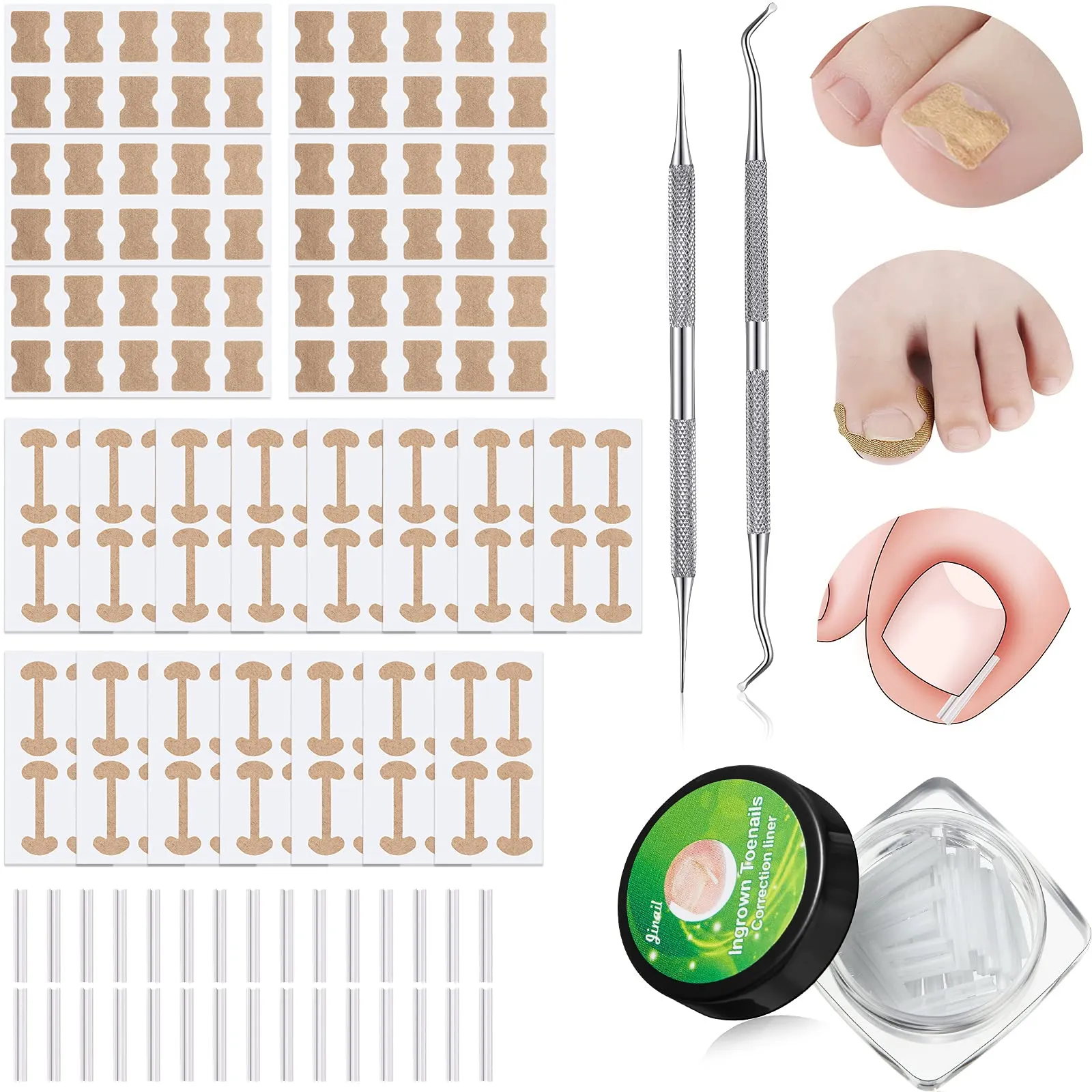 152 Pieces Ingrown Toenail Corrector Treatment Tool Sets, Include Curved Toenail